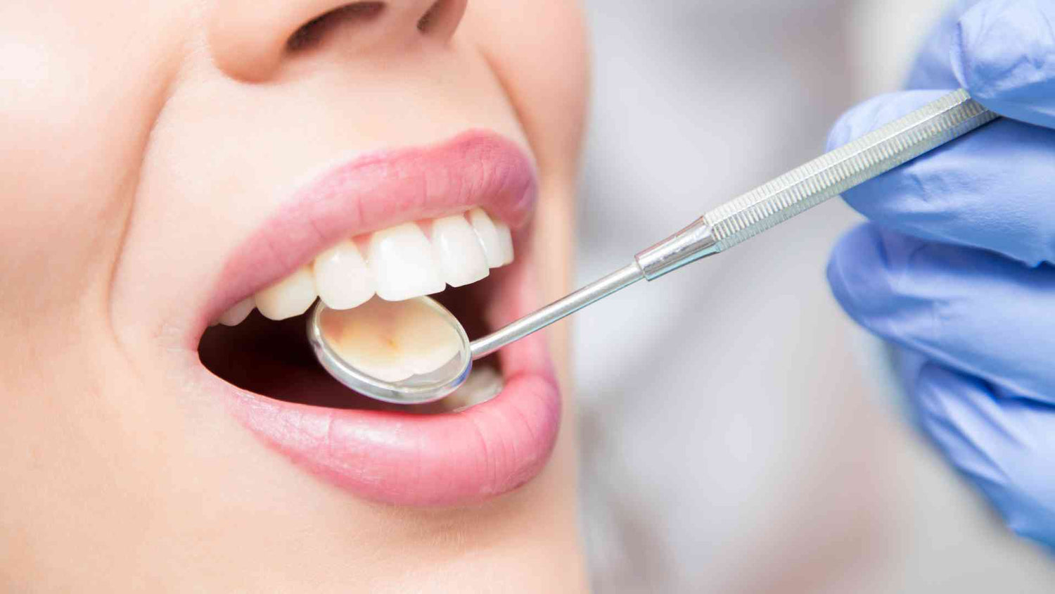 Zahnsteinentfernung beim Zahnarzt